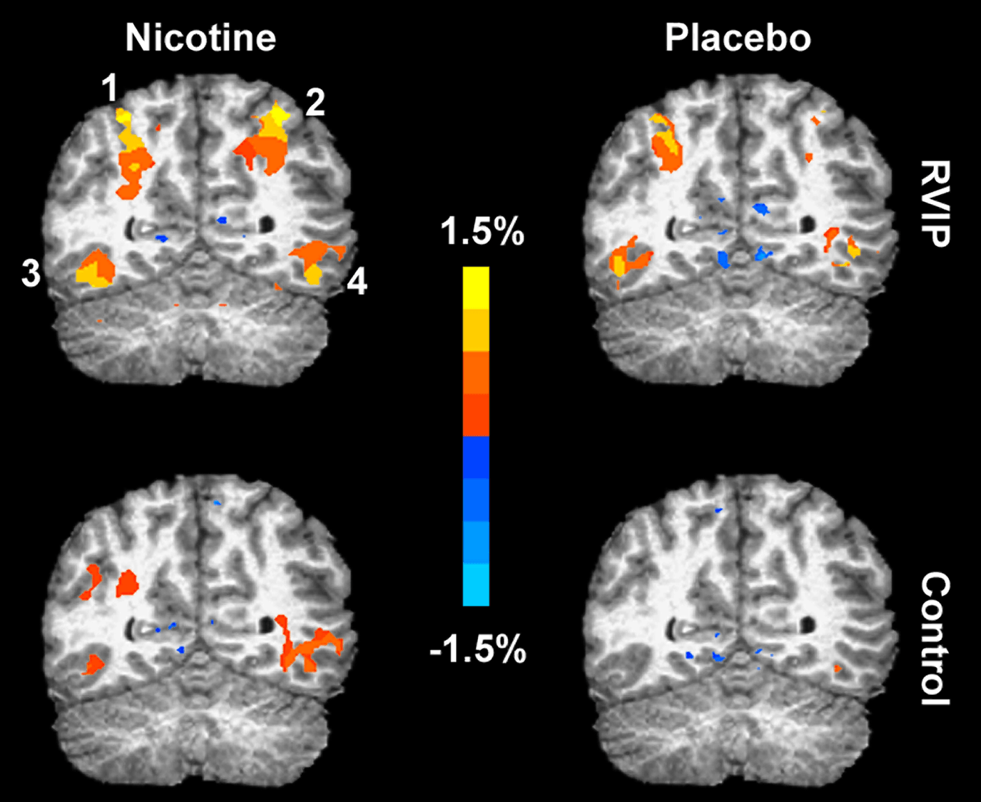 Nicotine Addiction And Your Brain | jeffreyshemp.com